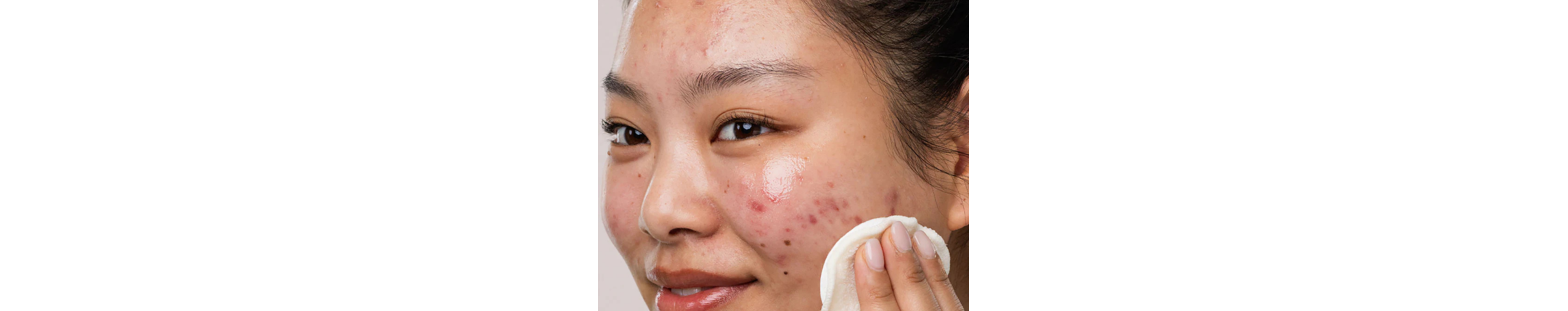Pack peau grasse à imperfections