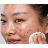 Pack peau grasse à imperfections